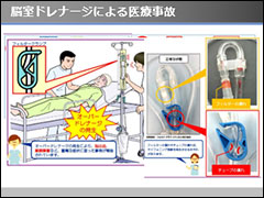 大阪脳神経外科病院