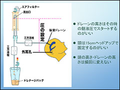 大阪脳神経外科病院