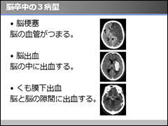 大阪脳神経外科病院